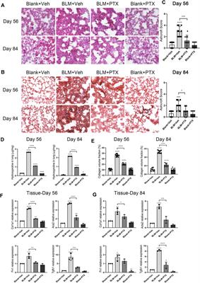 Pentoxifylline Inhibits Pulmonary Fibrosis by Regulating Cellular Senescence in Mice